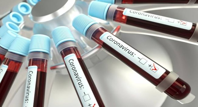 exame-do-coronavirus