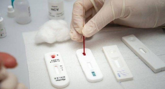 teste-rapido-coronavirus