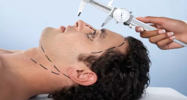 rinoplastia-homens