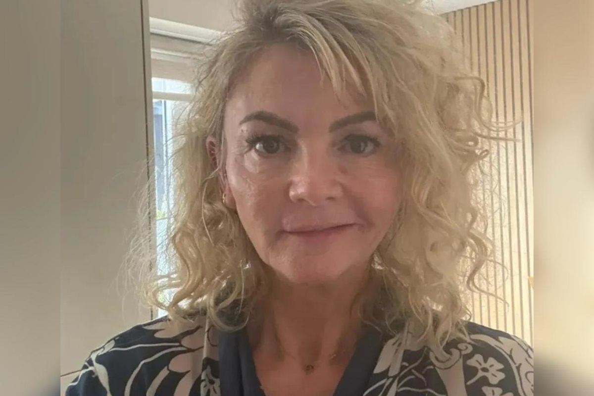 Mulher tem paralisia facial após cruzeiro de lua de mel cancelado - Imagem do artigo original
