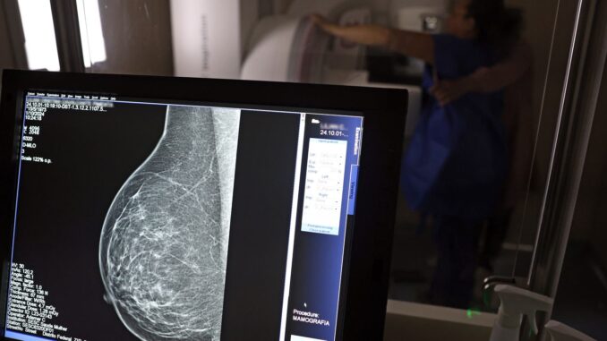 Imagem destacada - Saúde amplia mamografia no SUS para mulheres de 40 a 74 anos