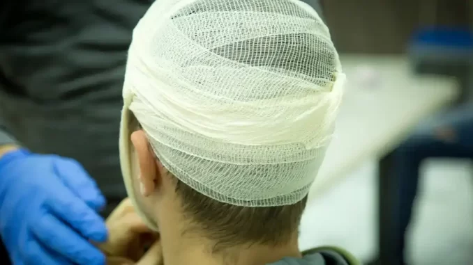 Paciente em atendimento médico após impacto na cabeça, destacando a importância de reconhecer sinais de trauma craniano leve que podem surgir dias depois.
