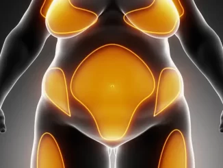 Ilustração do corpo humano destacando as áreas comuns onde a gordura se acumula, influenciadas por genética, hormônios e hábitos diários.