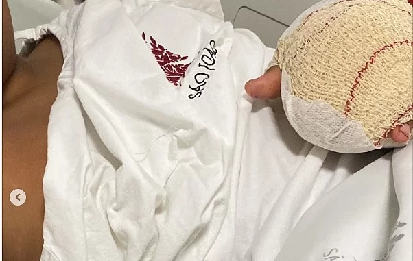 Imagem de um menino com o braço enfaixado após agressão na escola em Portugal, enquanto sua mãe denuncia o caso, que viralizou na mídia brasileira.