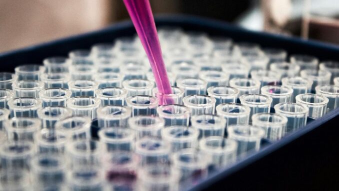 Imagem destacada - Inflamação cerebral pode desencadear e impulsionar avanço e progressão do Alzheimer