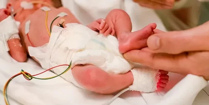 prematuridade-cuidados-penas-madres-recem-nascidos Recém-nascido prematuro recebendo cuidados especiais na UTI neonatal, destacando riscos e orientações para mães e profissionais de saúde.