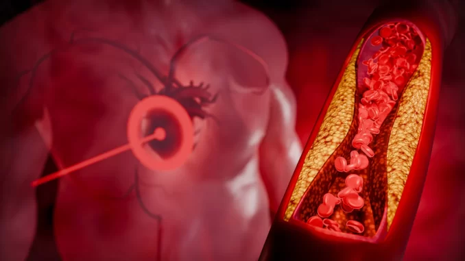Imagem destacada - Estudo indica que berinjela reduz colesterol em até quatro semanas